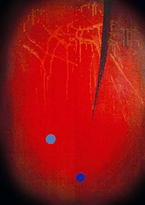 Galleri1
